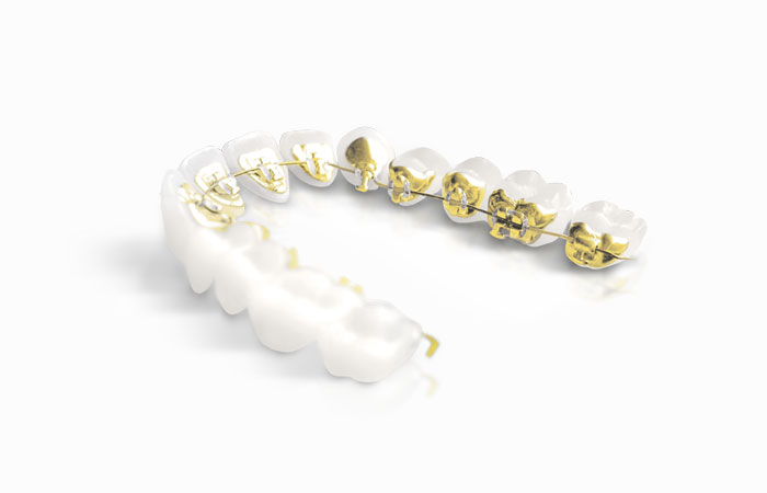 Incognito dr naoumi hicham orthodontiste rabat