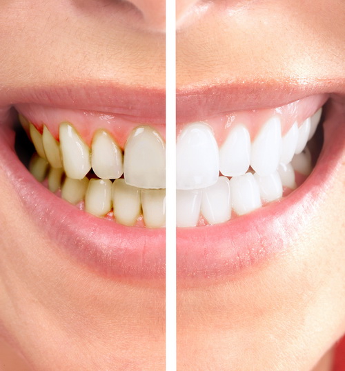 dentisserie dr naoumi hicham orthodontiste rabat